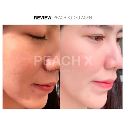 Peach X Collagen