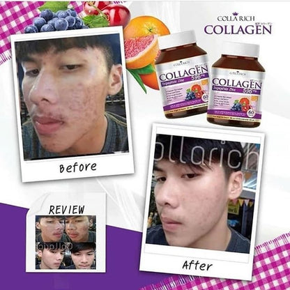 Colla Rich Collagen

Colla Rich Collagen new look is the dietary supplement
with collagen imported from Japan. It’s combined with
vitamin C, acerola cherry, and zinc